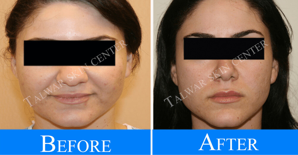 anti-ageing-before-after