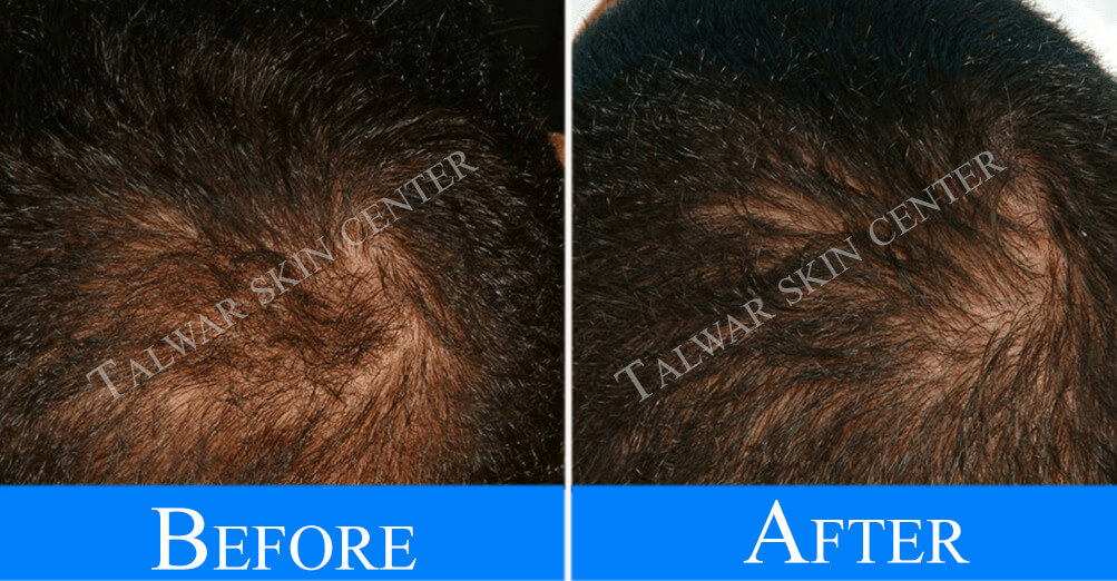 hair-management-before-after hair-management