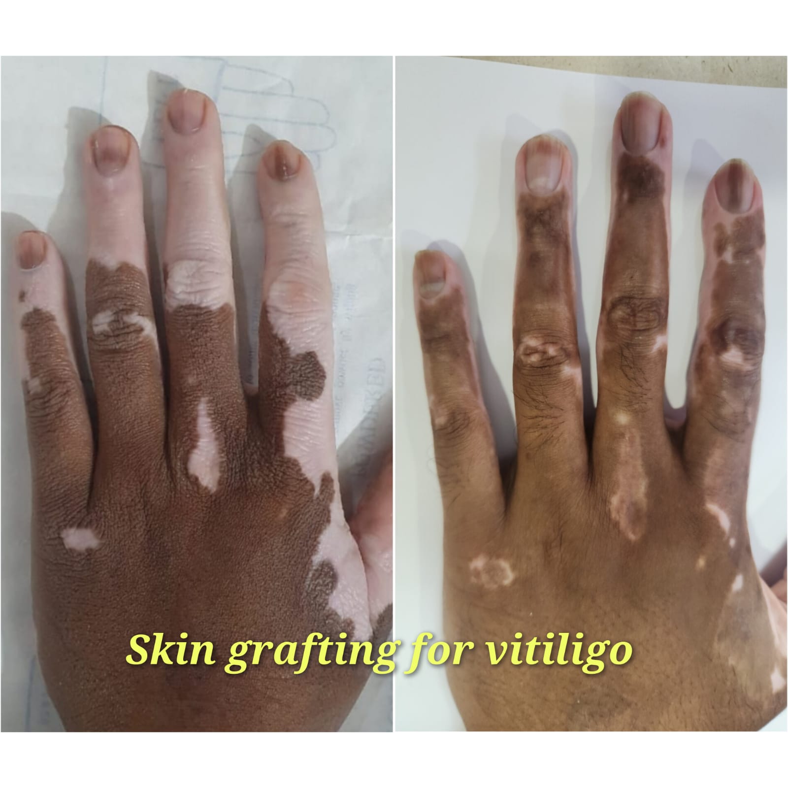 treatment2