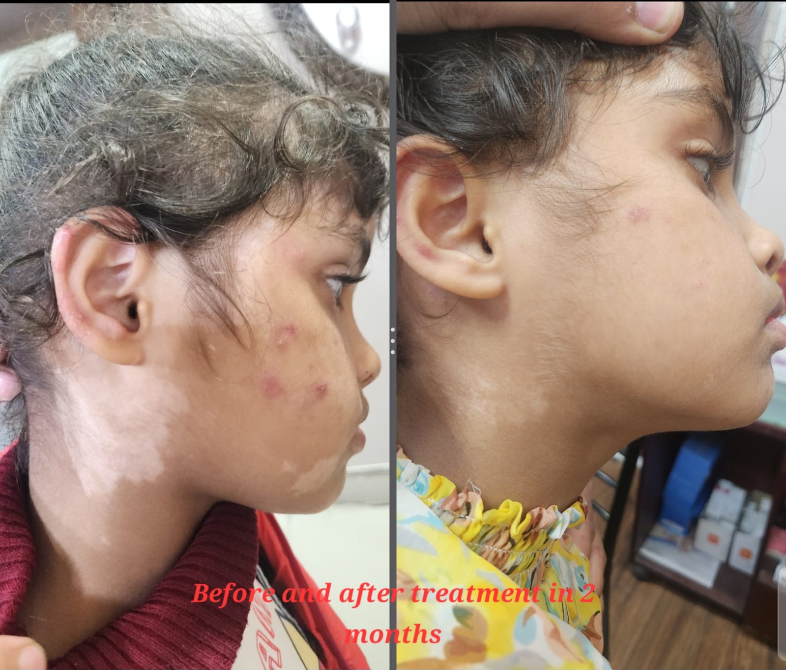 treatment3
