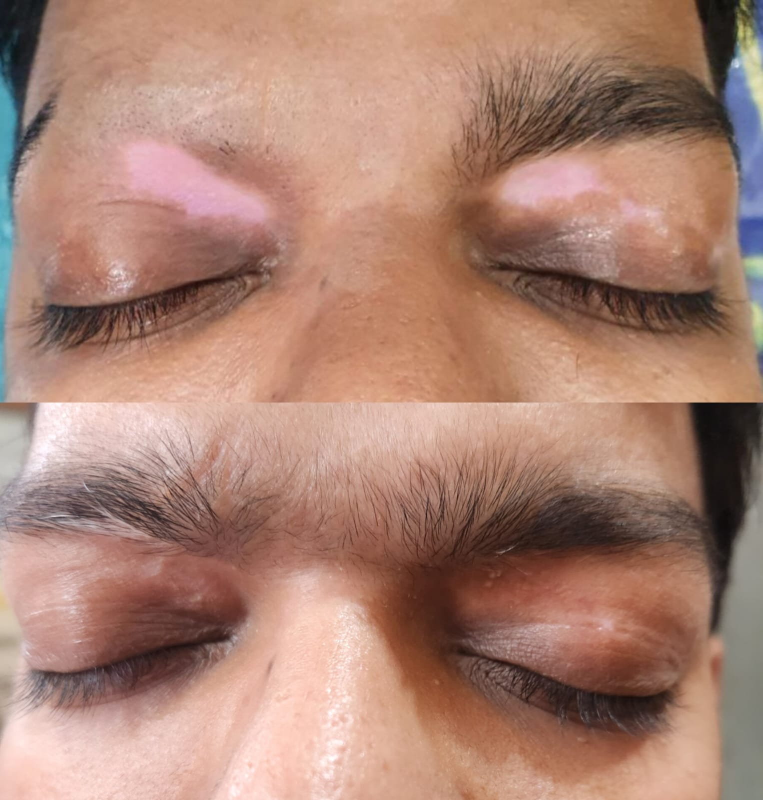 treatment4